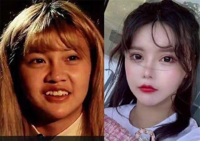 Han Anran: La influencer china que se hizo más de 30 cirugías y las complicaciones que sufre hoy