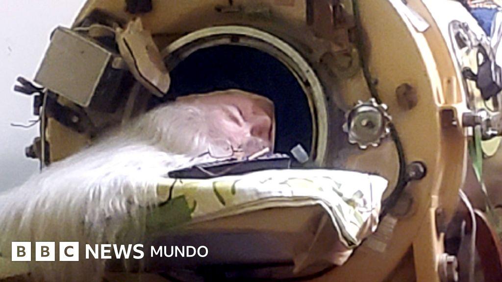Pulmón de acero: cómo vivió 73 años la última paciente de polio