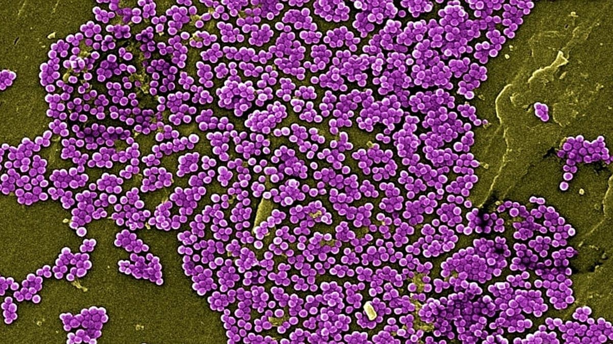 Un hallazgo científico abre el camino para neutralizar la resistencia de las bacterias a los antibióticos